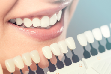 Find a Cosmetic dentist